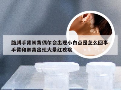 胳膊手背脚背偶尔会出现小白点是怎么回事 手臂和脚背出现大量红疙瘩