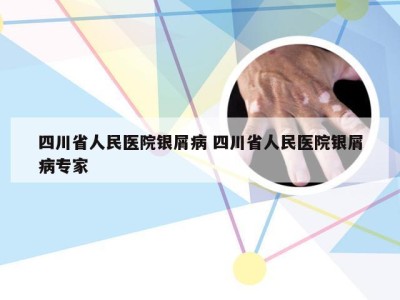 四川省人民医院银屑病 四川省人民医院银屑病专家