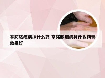 掌跖脓疱病抹什么药 掌跖脓疱病抹什么药膏效果好