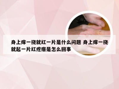 身上痒一挠就红一片是什么问题 身上痒一挠就起一片红疙瘩是怎么回事