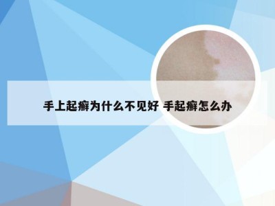 手上起癣为什么不见好 手起癣怎么办