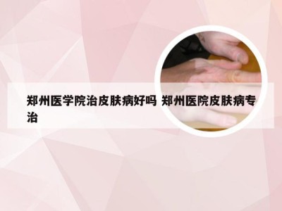 郑州医学院治皮肤病好吗 郑州医院皮肤病专治