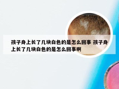 孩子身上长了几块白色的是怎么回事 孩子身上长了几块白色的是怎么回事啊