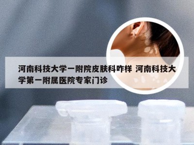 河南科技大学一附院皮肤科咋样 河南科技大学第一附属医院专家门诊