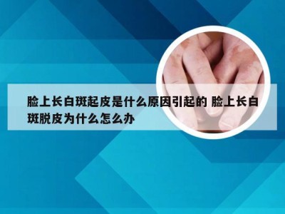 脸上长白斑起皮是什么原因引起的 脸上长白斑脱皮为什么怎么办