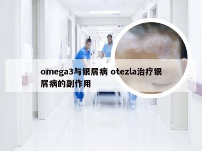 omega3与银屑病 otezla治疗银屑病的副作用