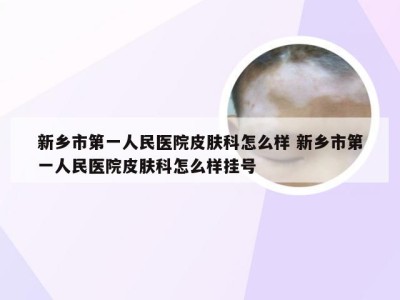 新乡市第一人民医院皮肤科怎么样 新乡市第一人民医院皮肤科怎么样挂号