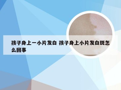 孩子身上一小片发白 孩子身上小片发白斑怎么回事