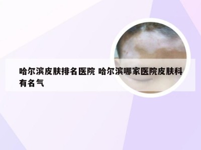 哈尔滨皮肤排名医院 哈尔滨哪家医院皮肤科有名气