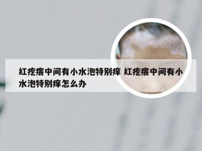 红疙瘩中间有小水泡特别痒 红疙瘩中间有小水泡特别痒怎么办