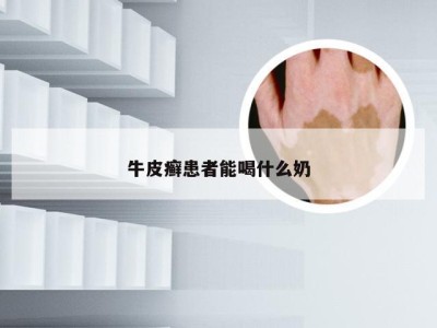 牛皮癣患者能喝什么奶