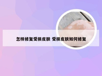 怎样修复受损皮肤 受损皮肤如何修复