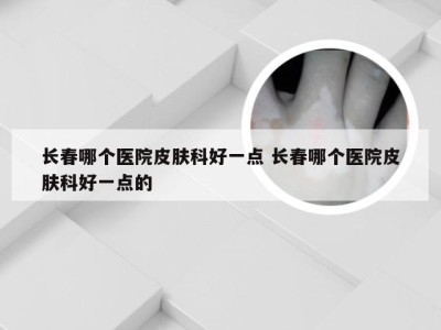 长春哪个医院皮肤科好一点 长春哪个医院皮肤科好一点的