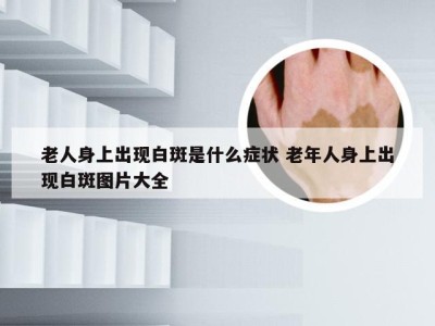 老人身上出现白斑是什么症状 老年人身上出现白斑图片大全