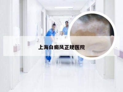 上海白癜风正规医院