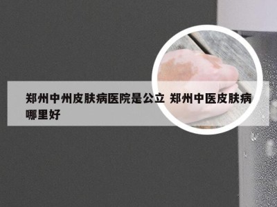 郑州中州皮肤病医院是公立 郑州中医皮肤病哪里好