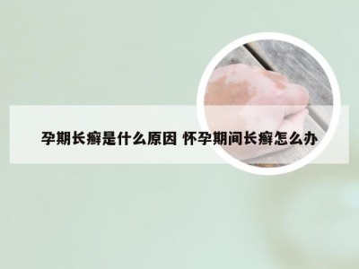 孕期长癣是什么原因 怀孕期间长癣怎么办