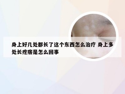 身上好几处都长了这个东西怎么治疗 身上多处长疙瘩是怎么回事