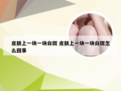 皮肤上一块一块白斑 皮肤上一块一块白斑怎么回事