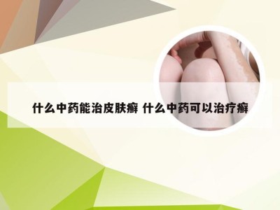 什么中药能治皮肤癣 什么中药可以治疗癣