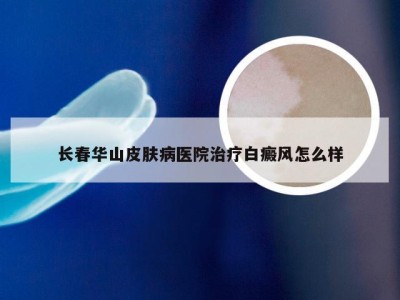 长春华山皮肤病医院治疗白癜风怎么样