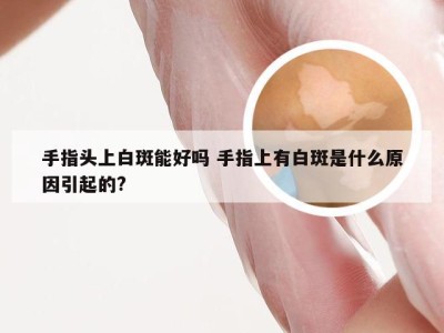 手指头上白斑能好吗 手指上有白斑是什么原因引起的?