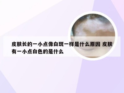 皮肤长的一小点像白斑一样是什么原因 皮肤有一小点白色的是什么