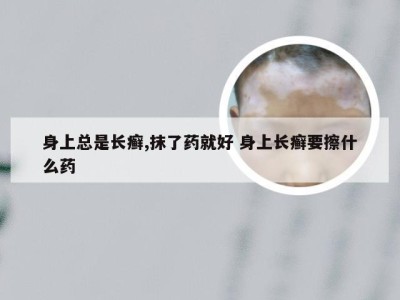 身上总是长癣,抹了药就好 身上长癣要擦什么药