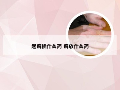 起癣插什么药 癣放什么药