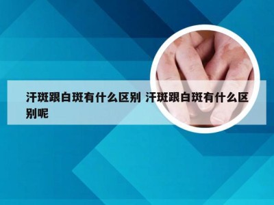 汗斑跟白斑有什么区别 汗斑跟白斑有什么区别呢