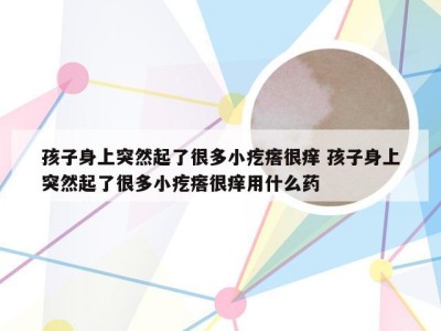 孩子身上突然起了很多小疙瘩很痒 孩子身上突然起了很多小疙瘩很痒用什么药