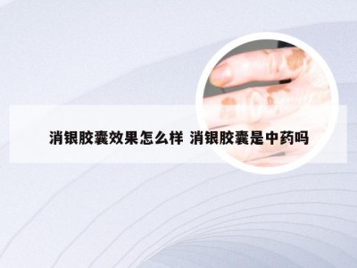 消银胶囊效果怎么样 消银胶囊是中药吗