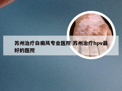 苏州治疗白癜风专业医院 苏州治疗hpv最好的医院