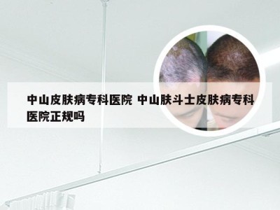 中山皮肤病专科医院 中山肤斗士皮肤病专科医院正规吗