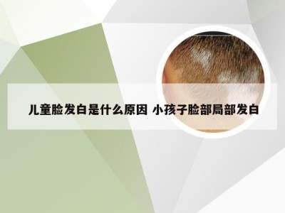 儿童脸发白是什么原因 小孩子脸部局部发白