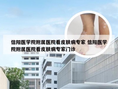 信阳医学院附属医院看皮肤病专家 信阳医学院附属医院看皮肤病专家门诊