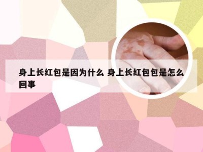 身上长红包是因为什么 身上长红包包是怎么回事