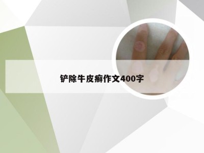 铲除牛皮癣作文400字