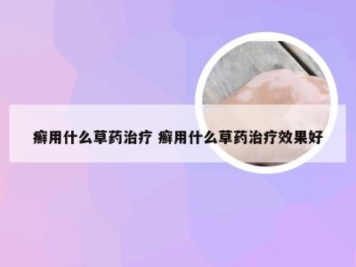 癣用什么草药治疗 癣用什么草药治疗效果好