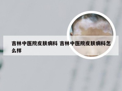 吉林中医院皮肤病科 吉林中医院皮肤病科怎么样