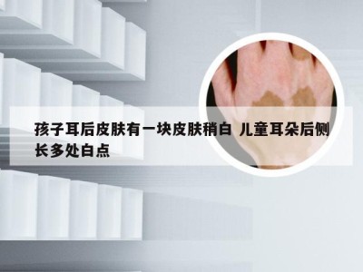 孩子耳后皮肤有一块皮肤稍白 儿童耳朵后侧长多处白点