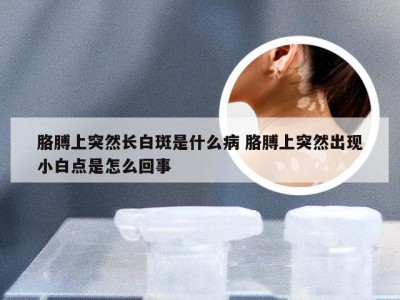 胳膊上突然长白斑是什么病 胳膊上突然出现小白点是怎么回事