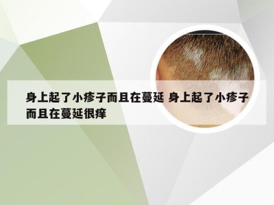 身上起了小疹子而且在蔓延 身上起了小疹子而且在蔓延很痒