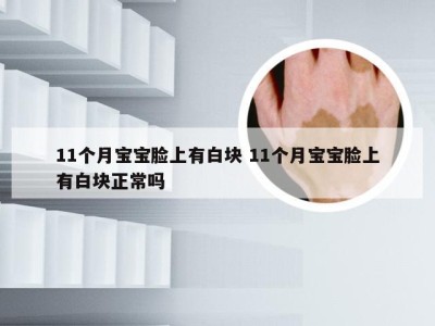 11个月宝宝脸上有白块 11个月宝宝脸上有白块正常吗