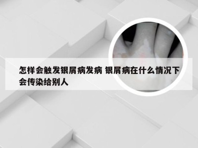 怎样会触发银屑病发病 银屑病在什么情况下会传染给别人