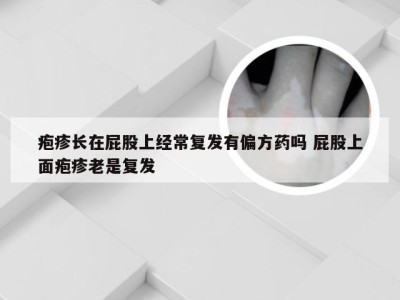 疱疹长在屁股上经常复发有偏方药吗 屁股上面疱疹老是复发