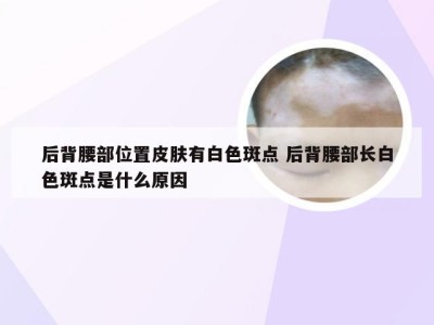 后背腰部位置皮肤有白色斑点 后背腰部长白色斑点是什么原因