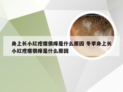 身上长小红疙瘩很痒是什么原因 冬季身上长小红疙瘩很痒是什么原因