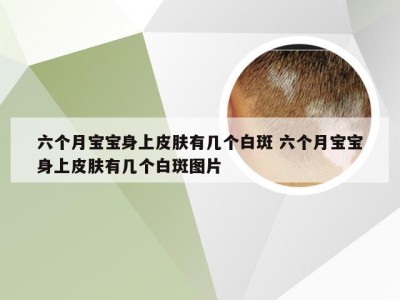 六个月宝宝身上皮肤有几个白斑 六个月宝宝身上皮肤有几个白斑图片