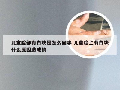 儿童脸部有白块是怎么回事 儿童脸上有白块什么原因造成的